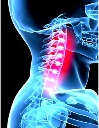 Clinical images of osteoarthritis